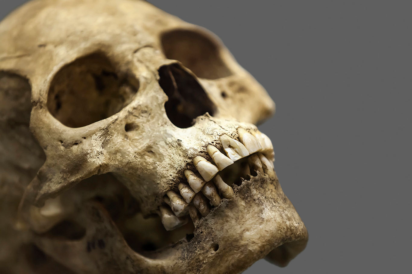 closeup of human skull