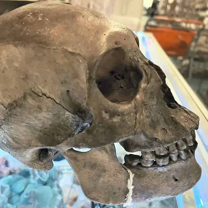 Close-up of the human skull in question